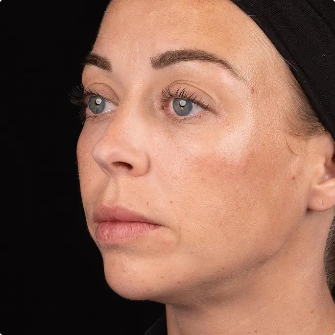 Before/After Image